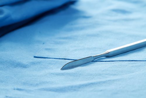 Women: Be Wary About “Vaginal Rejuvenation” Surgeries